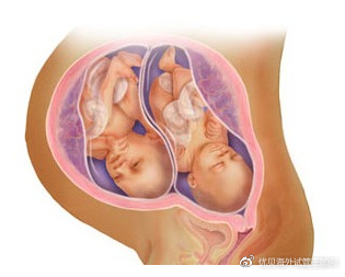 柳州43岁第三代试管婴儿的弊端_做泰国试管婴儿一定可以怀双胞胎吗？