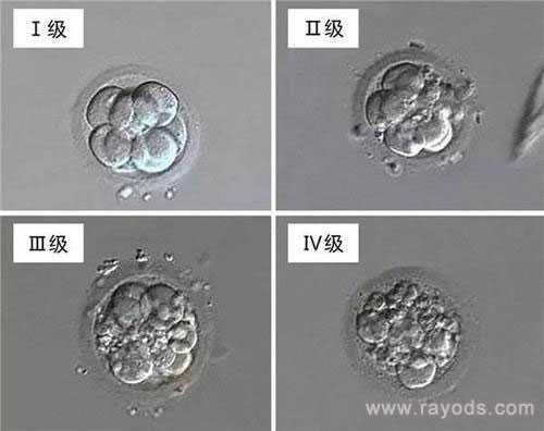 汉中借卵泡多少钱_做第二代试管婴儿没有优质胚胎怎么回事？